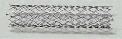 Image: The Complete SE Vascular Stent System (photo courtesy Medtronic).